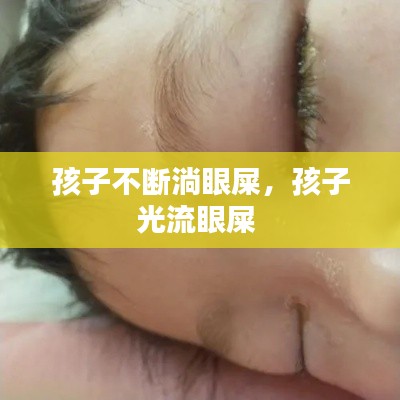 孩子不斷淌眼屎，孩子光流眼屎 