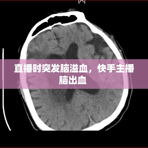 直播時(shí)突發(fā)腦溢血，快手主播腦出血 