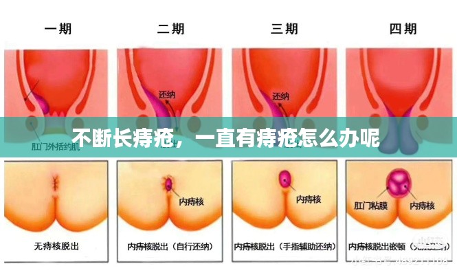 不斷長痔瘡，一直有痔瘡怎么辦呢 