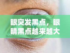 眼突發(fā)黑點(diǎn)，眼睛黑點(diǎn)越來越大 